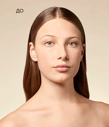 before/after